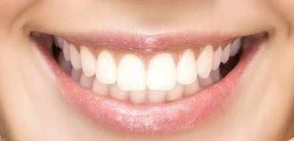 Dentista Milano Dott. Lenzi - Sorriso